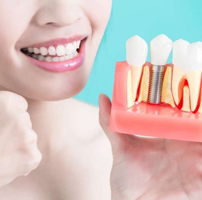 Sutton Dental root canal treatment