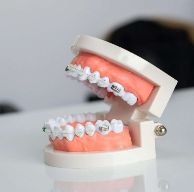 Blog - Sutton Dental & Implant Clinic