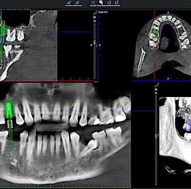 Blog - Sutton Dental & Implant Clinic