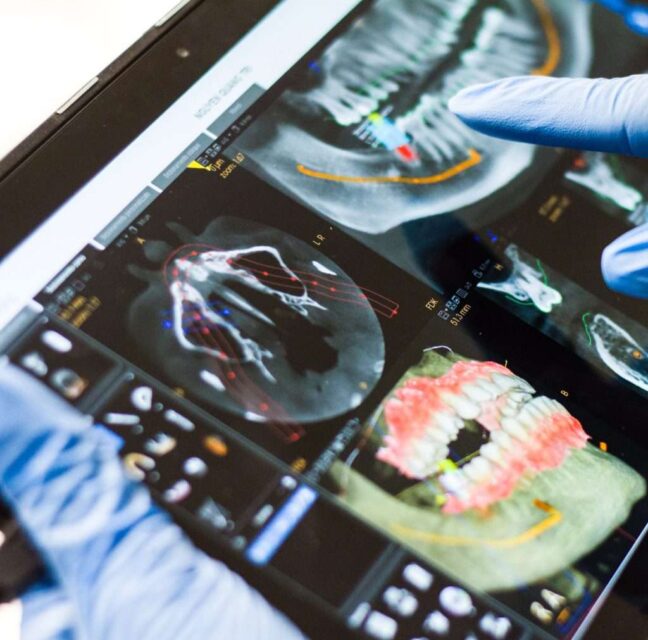 Blog - Sutton Dental & Implant Clinic