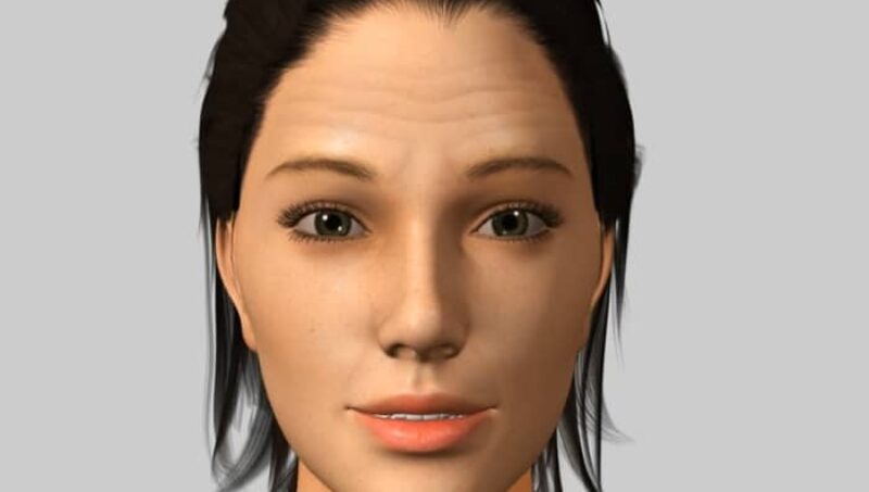 Sutton Dental Wrinkle Correction Video