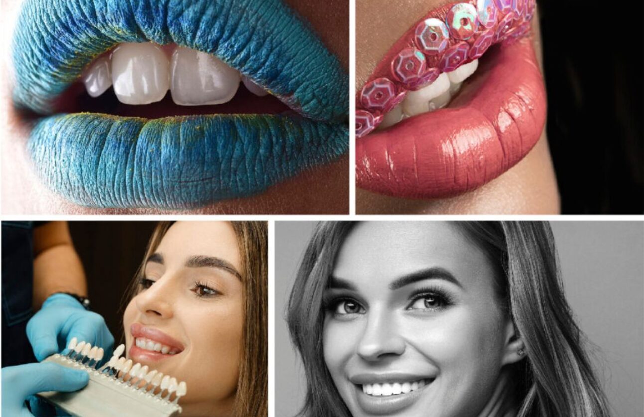 Sutton Dental Boutique Teeth Whitening