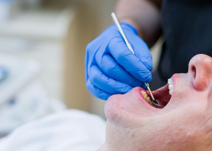 Composite bonding Sutton