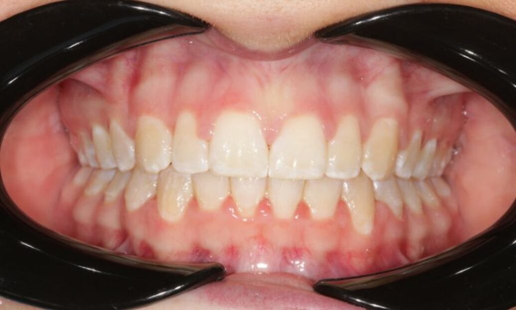 Sutton Dental case 10 after