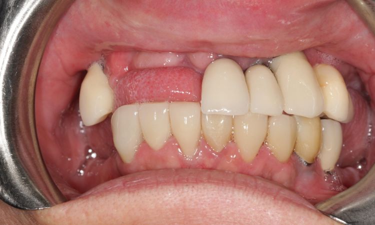 Sutton Dental Case 8 Before