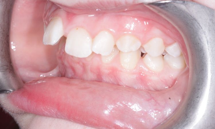 Sutton Dental Case 9 Before