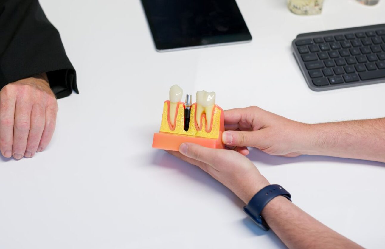 Sutton Missing Multiple Teeth