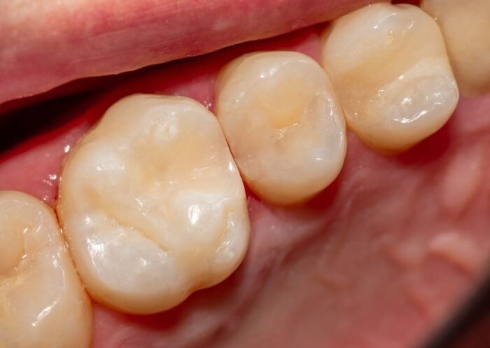 Sutton Dental & Implant Clinic