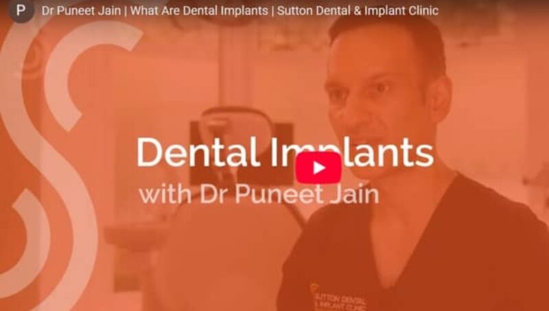 Treatment Video Preview : Sutton Dental & Implant Clinic