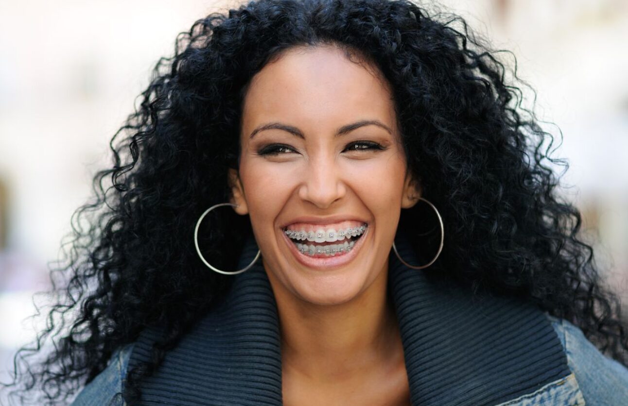 Why Sutton Dental fixed braces?