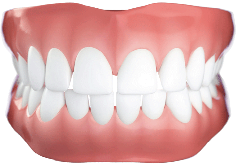 invisalign before after