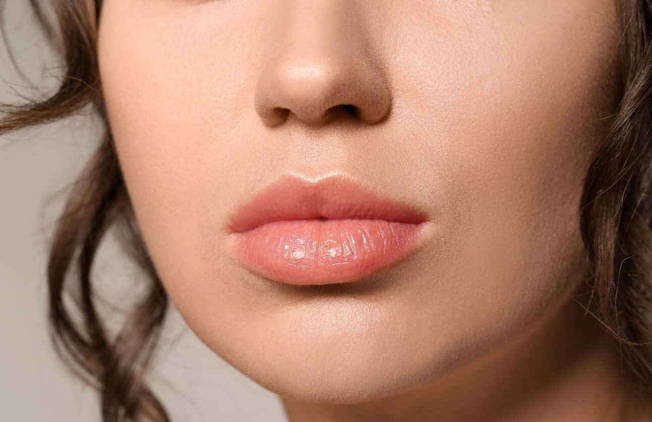 Sutton Dental Digital Lips