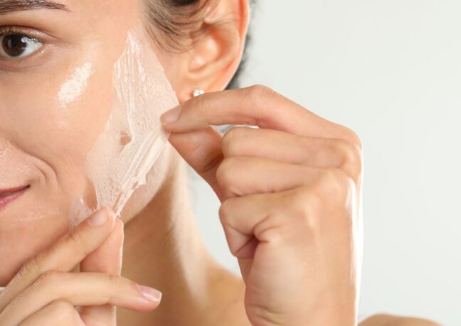 Sutton Dental & Implant Clinic Chemical Peels