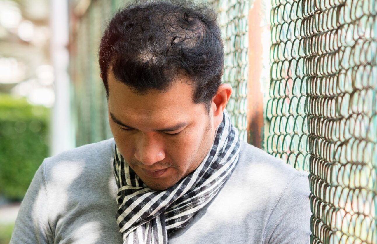 Sutton Dental Hair Restoration